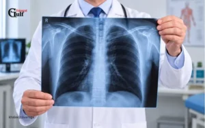 Chest X-Ray